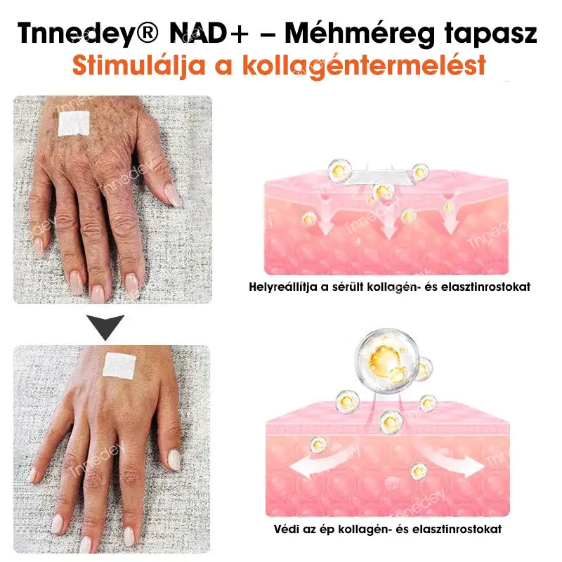 Tnnedey® tapaszok NAD+-szal és méhméreggel – Maximális bőrfiatalítás és energiabomba