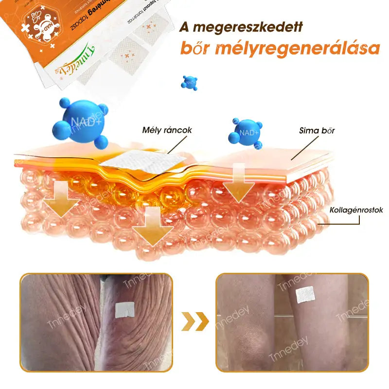 Tnnedey® tapaszok NAD+-szal és méhméreggel – Maximális bőrfiatalítás és energiabomba